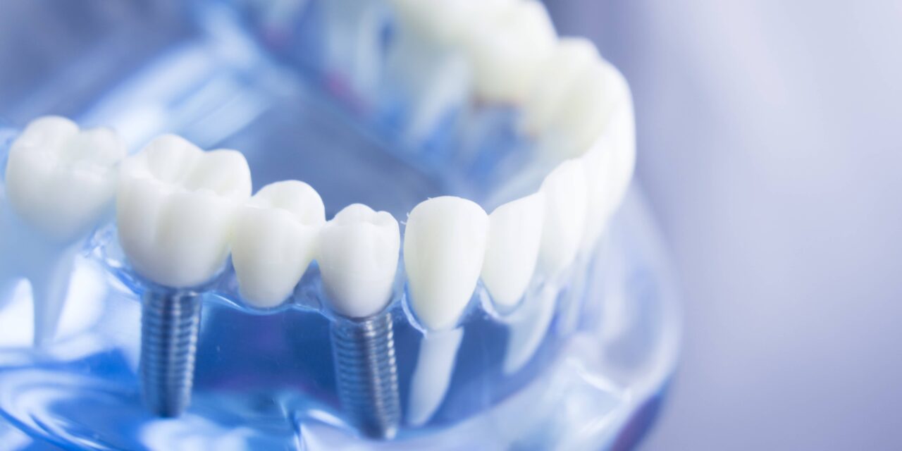 Smile Dental Side Dental Prostheses
