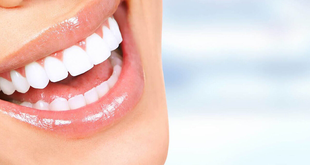 Warum İst Eine Side Zahn Klinik Wichtig?
