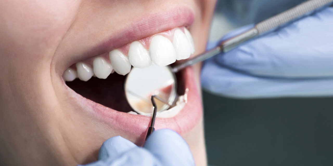 Dental implants Side